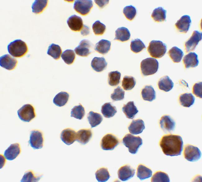 Acinus Antibody in Immunocytochemistry (ICC/IF)