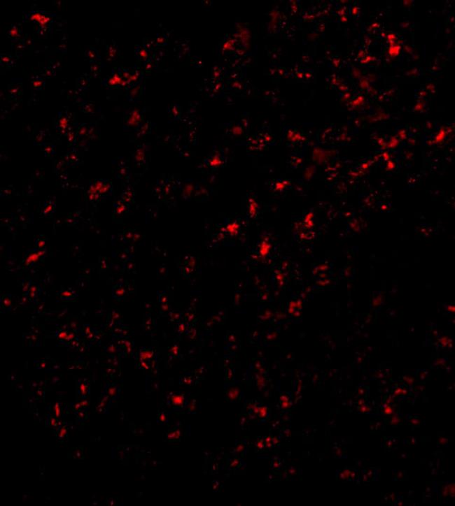 F1A alpha Antibody in Immunocytochemistry (ICC/IF)