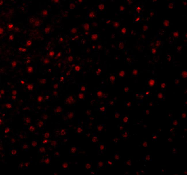 Caspase 12 Antibody in Immunocytochemistry (ICC/IF)