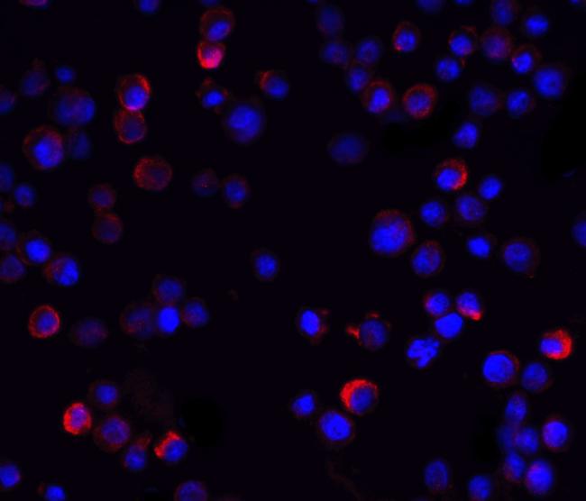 IKK gamma Antibody in Immunocytochemistry (ICC/IF)