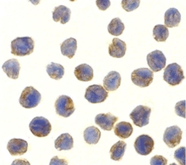 TBK1 Antibody in Immunocytochemistry (ICC/IF)