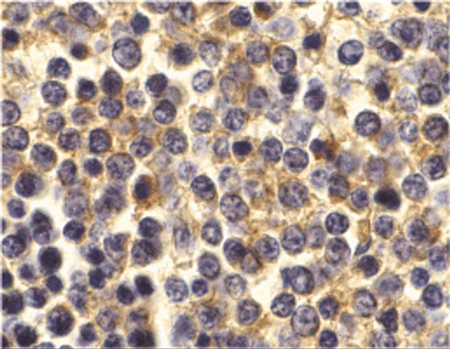 BCMA Antibody in Immunohistochemistry (Paraffin) (IHC (P))