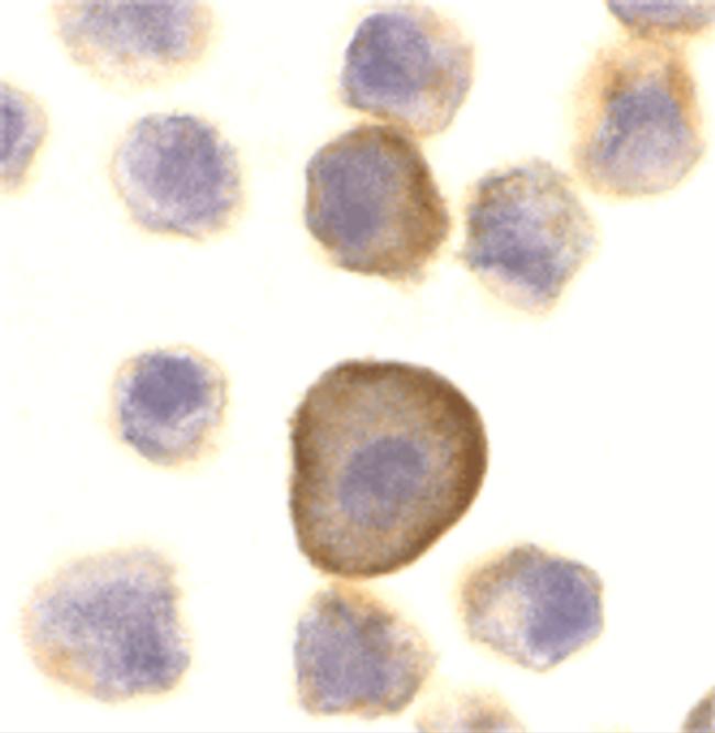 PERP Antibody in Immunocytochemistry (ICC/IF)