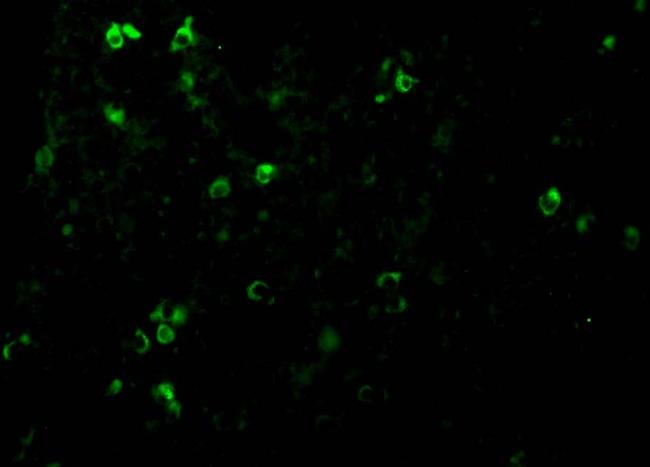 TCCR Antibody in Immunocytochemistry (ICC/IF)