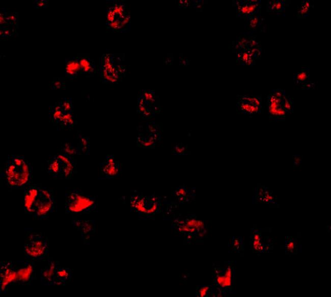 PUMA alpha Antibody in Immunocytochemistry (ICC/IF)