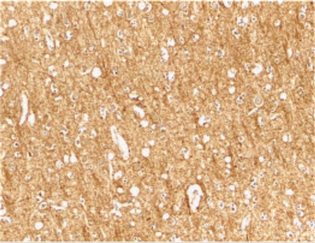 TEM8 Antibody in Immunohistochemistry (IHC)