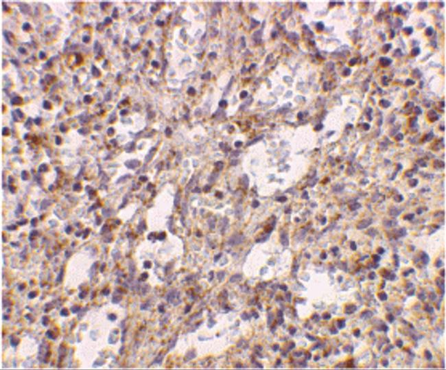 TLR2 Antibody in Immunohistochemistry (IHC)