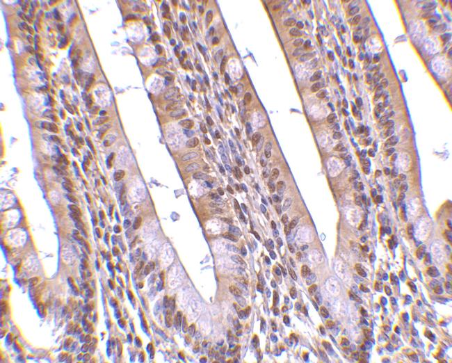 PHAP Antibody in Immunohistochemistry (IHC)