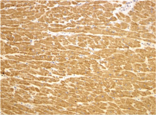 TIRAP Antibody in Immunohistochemistry (IHC)