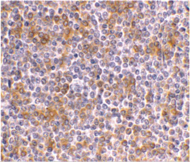 APOBEC3G Antibody in Immunohistochemistry (IHC)