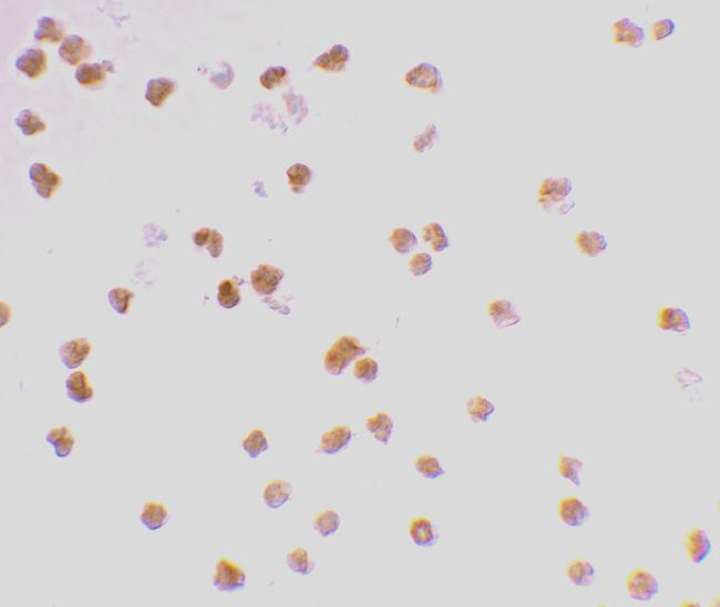 TLR7 Antibody in Immunocytochemistry (ICC/IF)