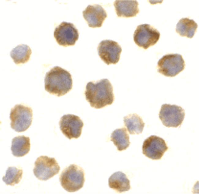 Bcl-2 Antibody in Immunocytochemistry (ICC/IF)