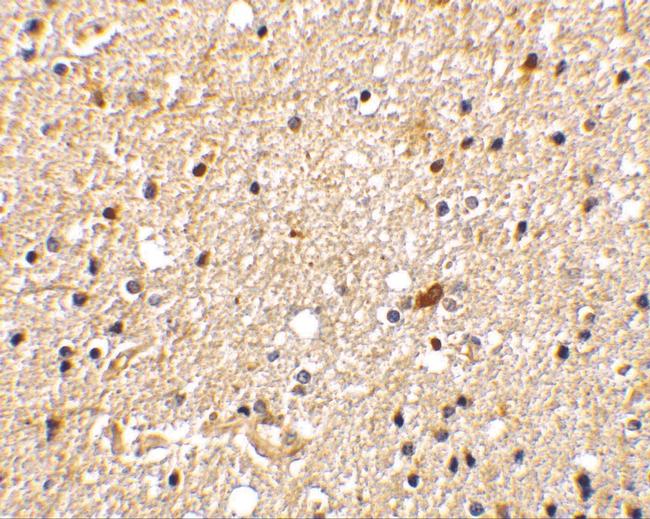 NADE Antibody in Immunohistochemistry (IHC)