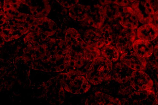 ST2 Antibody in Immunocytochemistry (ICC/IF)