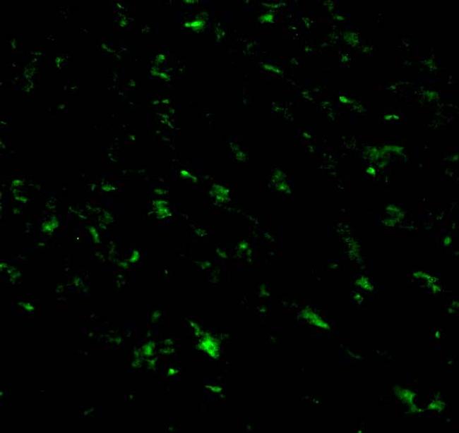 RNF216 Antibody in Immunocytochemistry (ICC/IF)