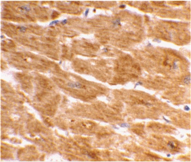 Caspase 1 Antibody in Immunohistochemistry (IHC)