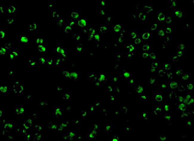 TSC1 Antibody in Immunocytochemistry (ICC/IF)