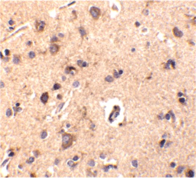 CTRP2 Antibody in Immunohistochemistry (IHC)