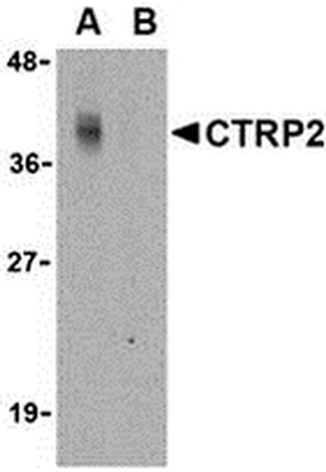 CTRP2 Antibody in Western Blot (WB)