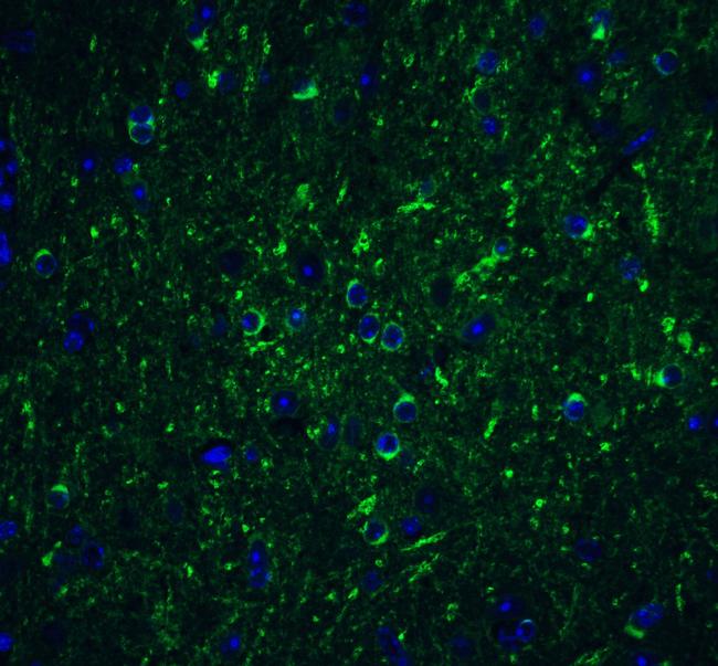 Beclin 1 Antibody in Immunohistochemistry (IHC)