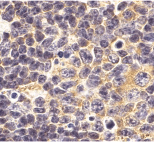 TLR1 Antibody in Immunohistochemistry (IHC)