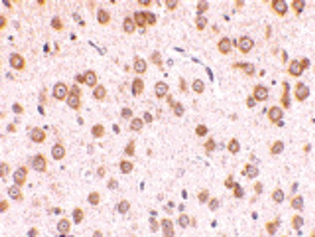 TLR5 Antibody in Immunohistochemistry (IHC)