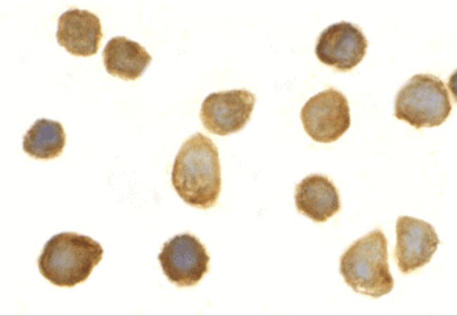 TOLLIP Antibody in Immunocytochemistry (ICC/IF)