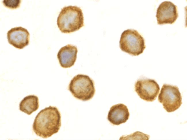 TOLLIP Antibody in Immunocytochemistry (ICC/IF)