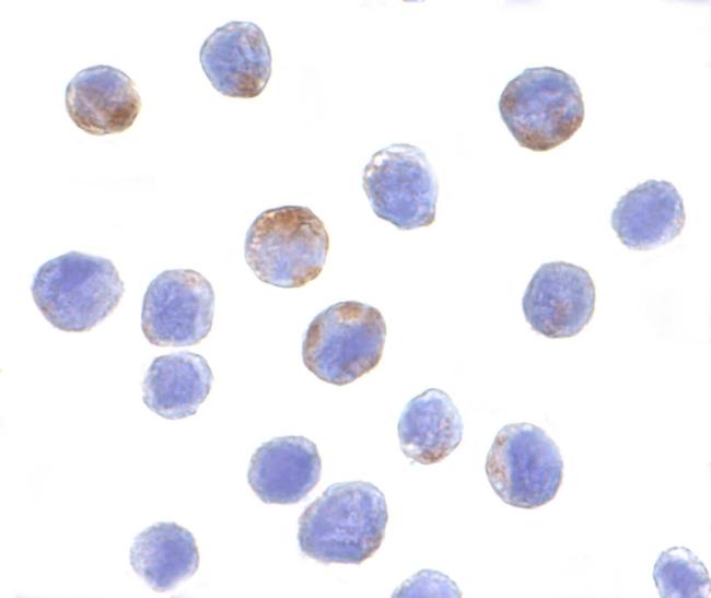 DDX3 Antibody in Immunocytochemistry (ICC/IF)