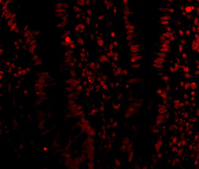 LSD1 Antibody in Immunocytochemistry (ICC/IF)