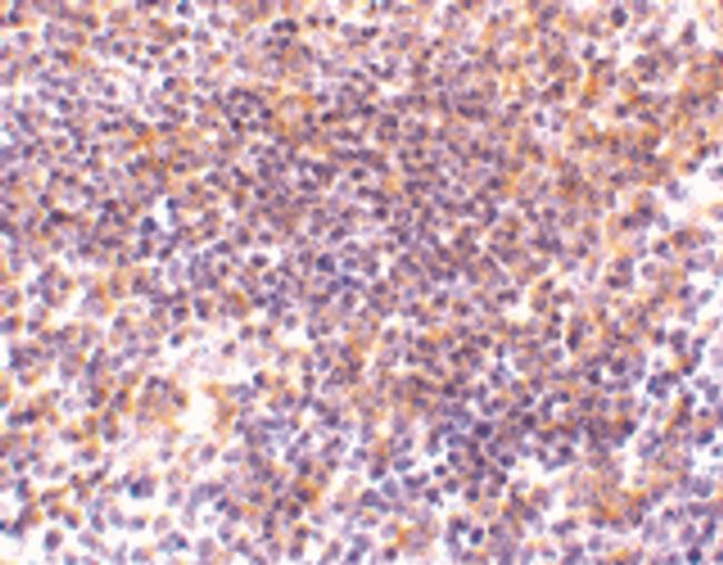 PAK2 Antibody in Immunohistochemistry (Paraffin) (IHC (P))