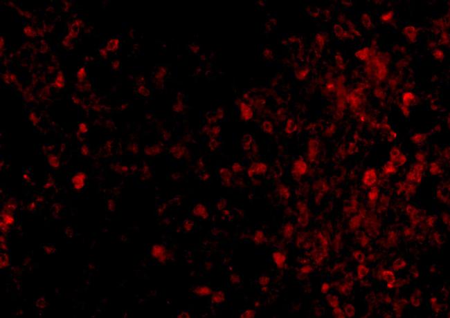 TRPC6 Antibody in Immunocytochemistry (ICC/IF)