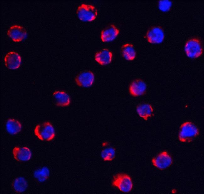 TRPC6 Antibody in Immunocytochemistry (ICC/IF)