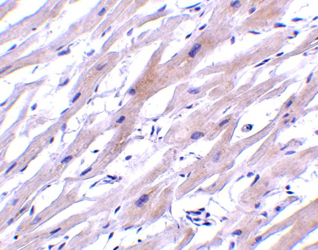 UNG Antibody in Immunohistochemistry (Paraffin) (IHC (P))