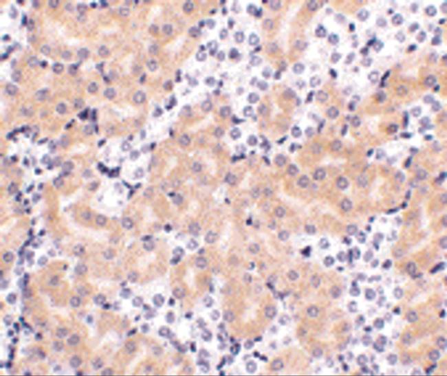 BCL2A1 Antibody in Immunohistochemistry (IHC)