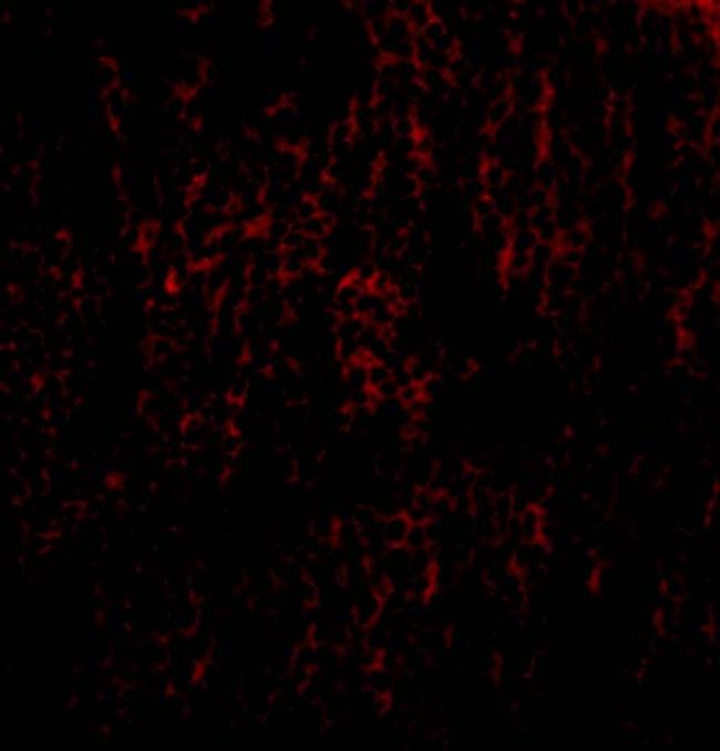 TANK Antibody in Immunocytochemistry (ICC/IF)