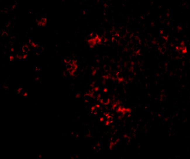 PAK2 Antibody in Immunocytochemistry (ICC/IF)