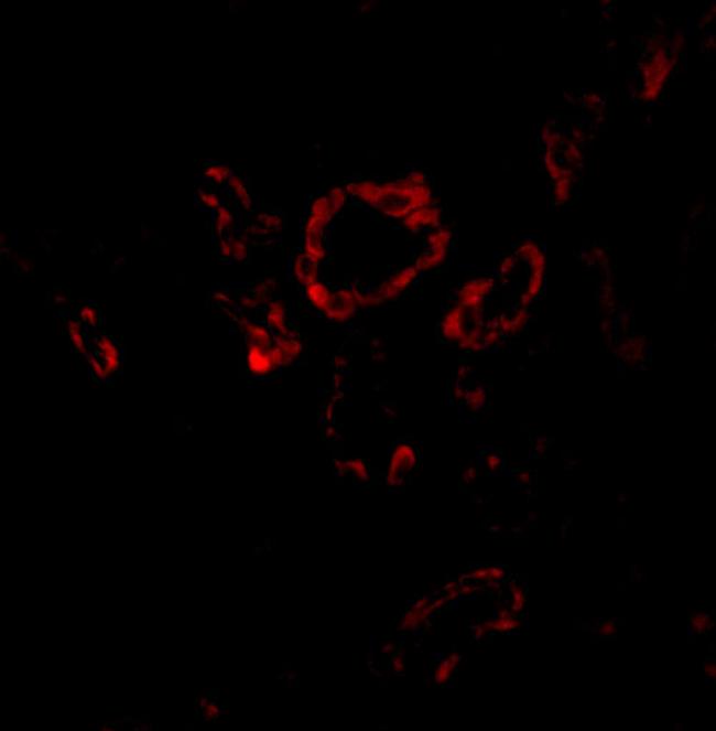 SLUG Antibody in Immunohistochemistry (IHC)