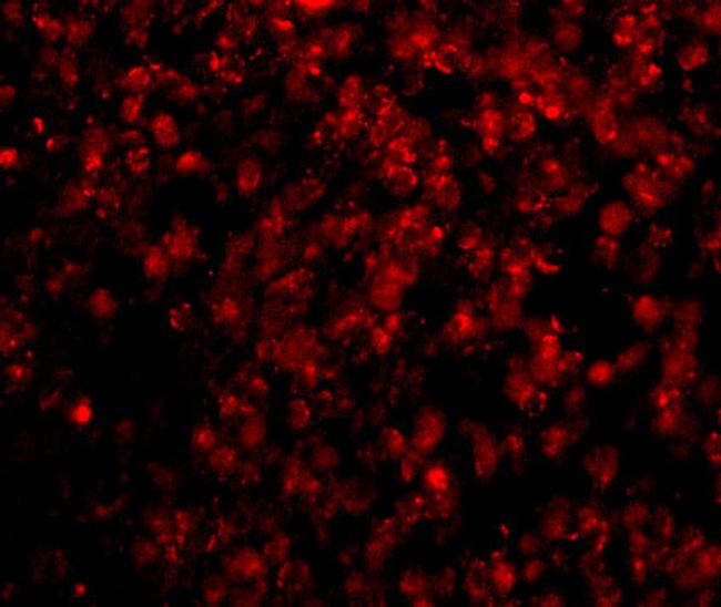 HSL Antibody in Immunocytochemistry (ICC/IF)