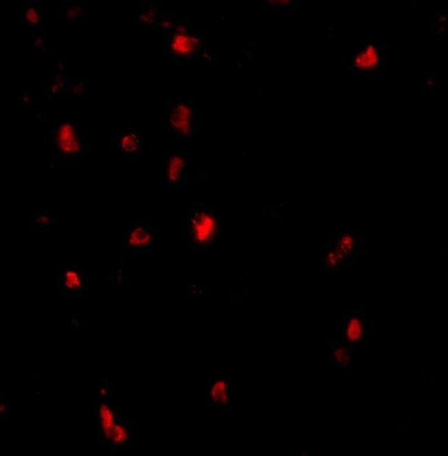 c-Cbl Antibody in Immunohistochemistry (IHC)