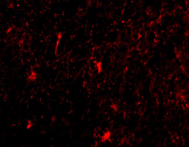 Nicastrin Antibody in Immunocytochemistry (ICC/IF)