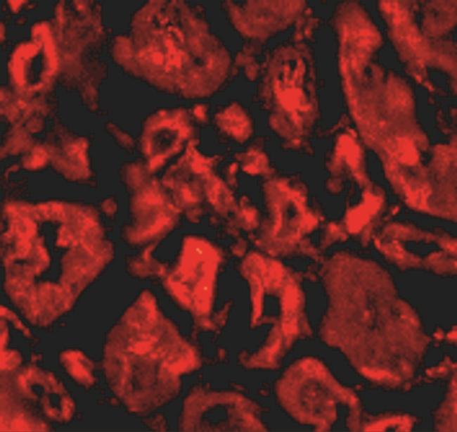 SNW1 Antibody in Immunohistochemistry (IHC)