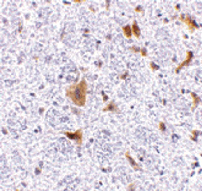 LFG Antibody in Immunohistochemistry (IHC)