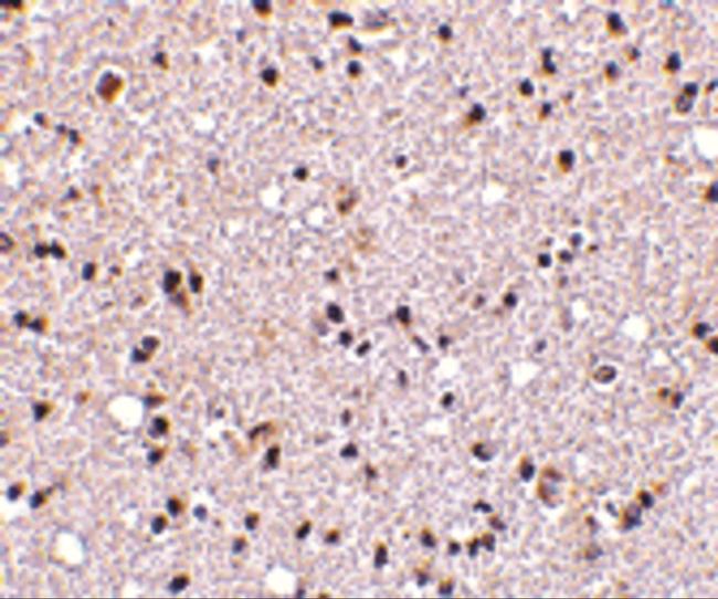 TMP21 Antibody in Immunohistochemistry (IHC)