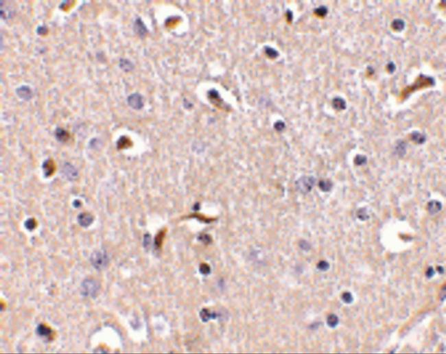 APH1 Antibody in Immunohistochemistry (IHC)