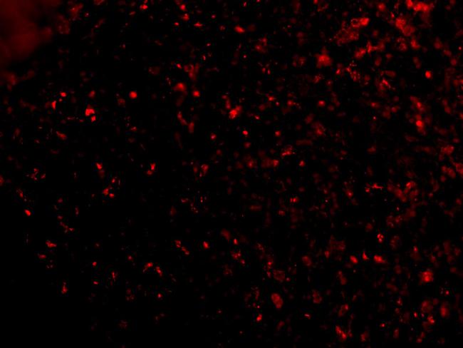 ORAI1 Antibody in Immunocytochemistry (ICC/IF)