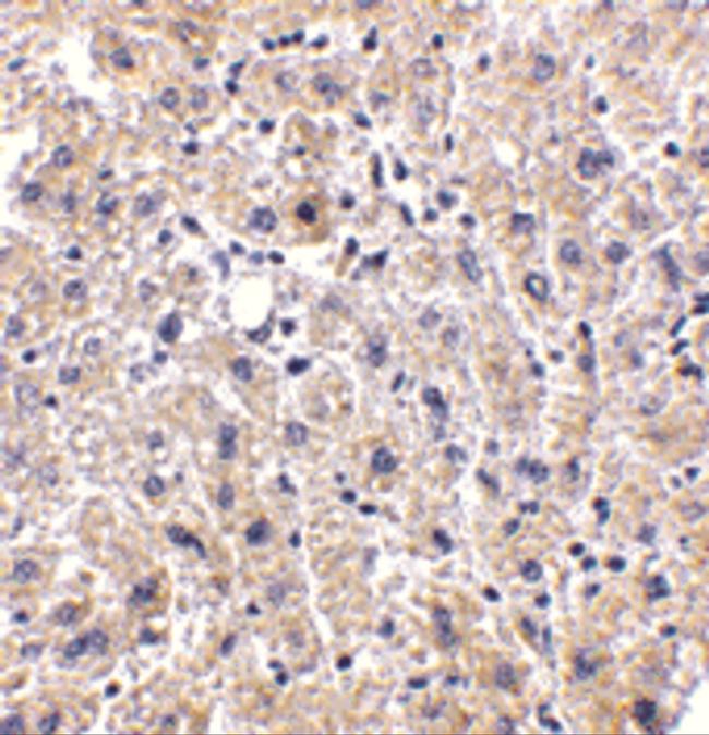 DRAM Antibody in Immunohistochemistry (Paraffin) (IHC (P))