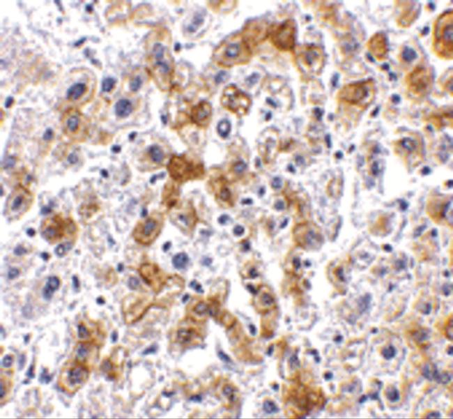 SCO2 Antibody in Immunohistochemistry (IHC)