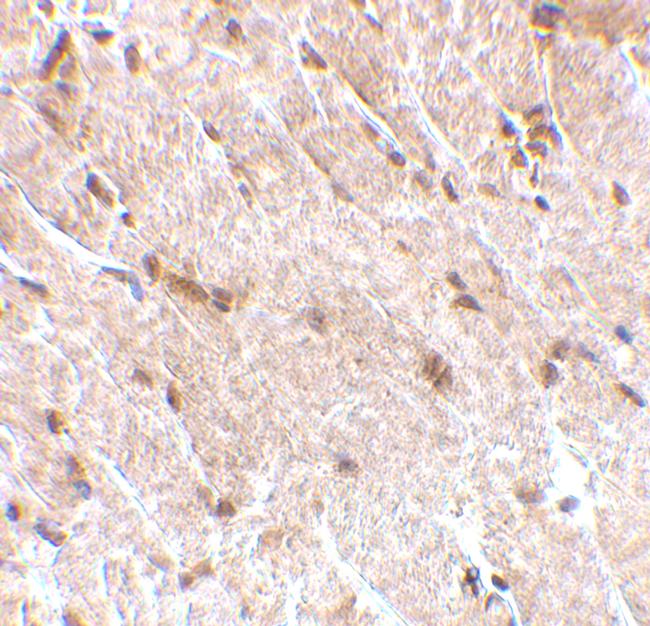 MAPKAP1 Antibody in Immunohistochemistry (IHC)