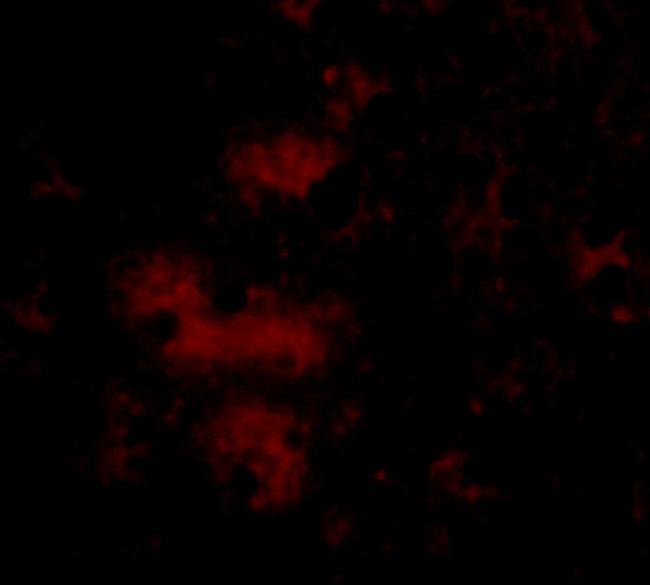 STIM2 Antibody in Immunocytochemistry (ICC/IF)